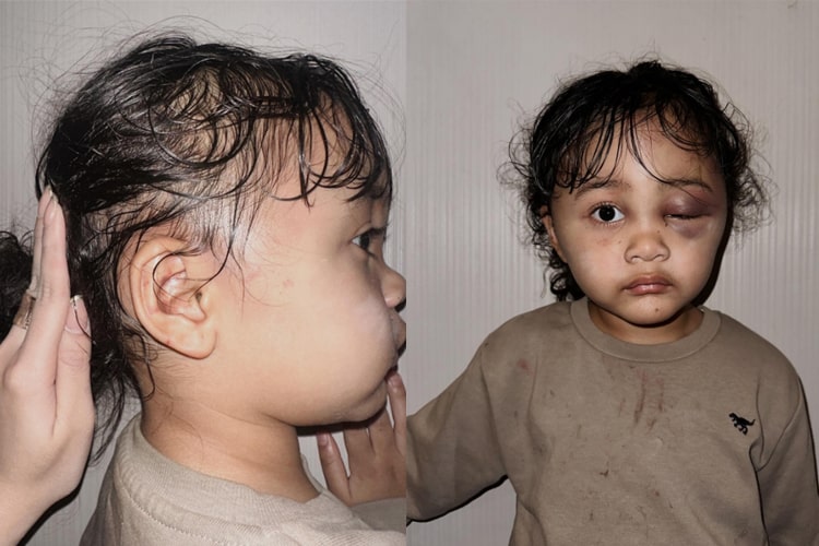 Selebgram Aghnia Punjabi,Aghnia Punjabi,Selebgram,Emy Aghnia,Aghnia,Punjabi,Malang,Foto,Kondisi,Anak Selebgram,Anak,Pengasuh,Suster,Babysitter,Penganiayaan Selebgram Aghnia Punjabi Murka, Buah Hati Dianiaya Pengasuh